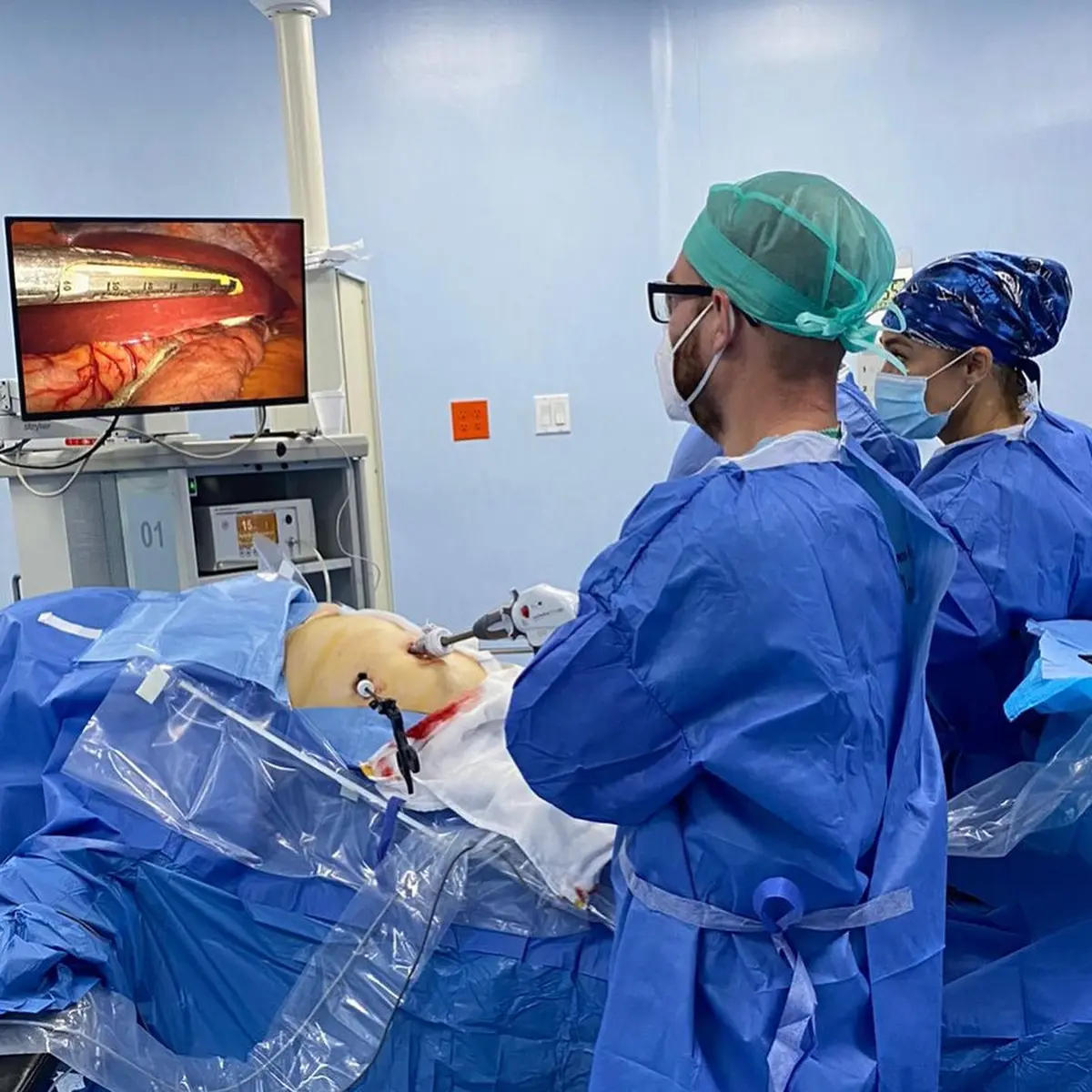 Bariatric surgery in progress