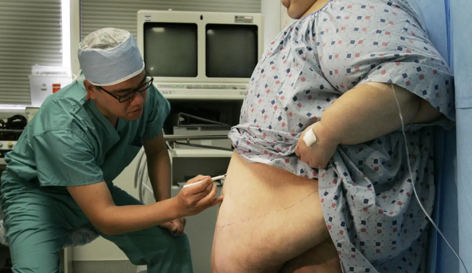 Bariatric Surgery: Why Patients Choose Mexicali Over Tijuana