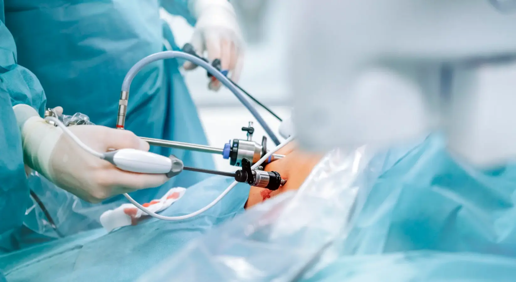 How Long Is Recovery After Bariatric Surgery in Mexico?